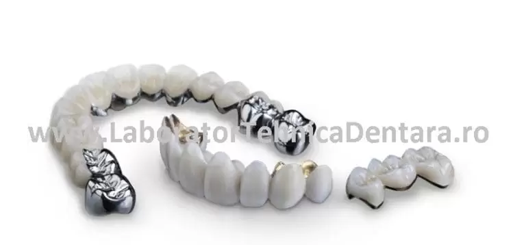 Punte Ceramica pe Titan