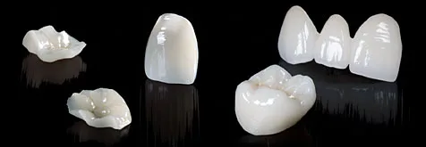 Inlay, Onlay, Fațete și Coroane integral ceramice EMAX