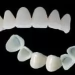 Punte | Coroana Dentara Provizorie