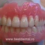 reparatii proteze dentare totale
