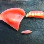 reparatie proteza dentara