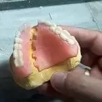 reparatie proteza mobila