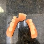 reparatie proteza inferioara