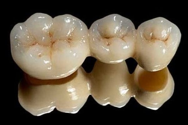 coroana zirconiu